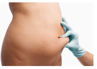 Remodelage de la silhouette liposuccion ou liposculpture ou lipoaspiration?